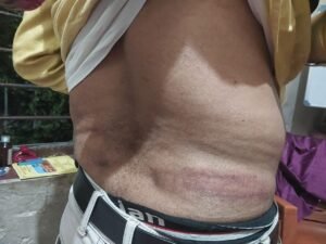 पत्रकार पर हमला करने वालों पर अविलंब हो कार्रवाई - देवानंद सिन्हा