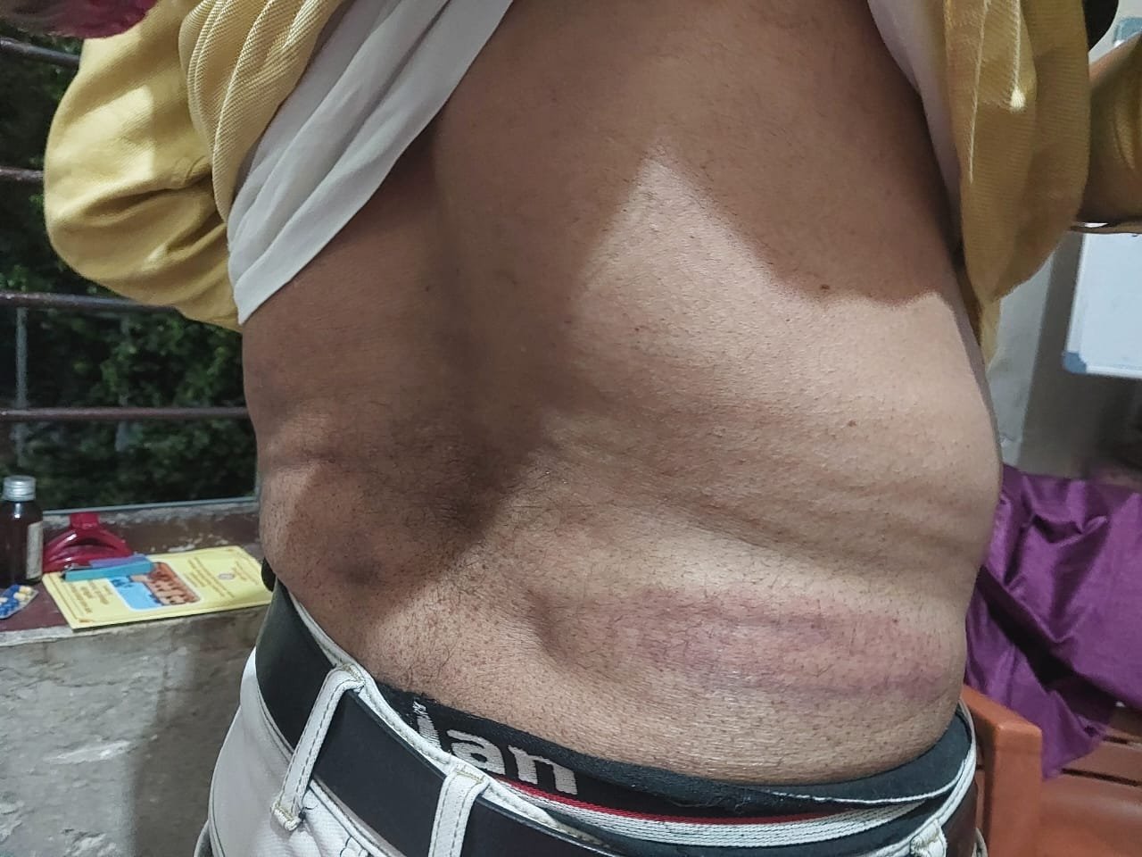 पत्रकार पर हमला करने वालों पर अविलंब हो कार्रवाई - देवानंद सिन्हा